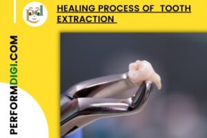 Healing process of tooth Extraction extraction